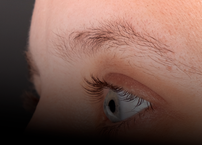 Eyebrow Transplant