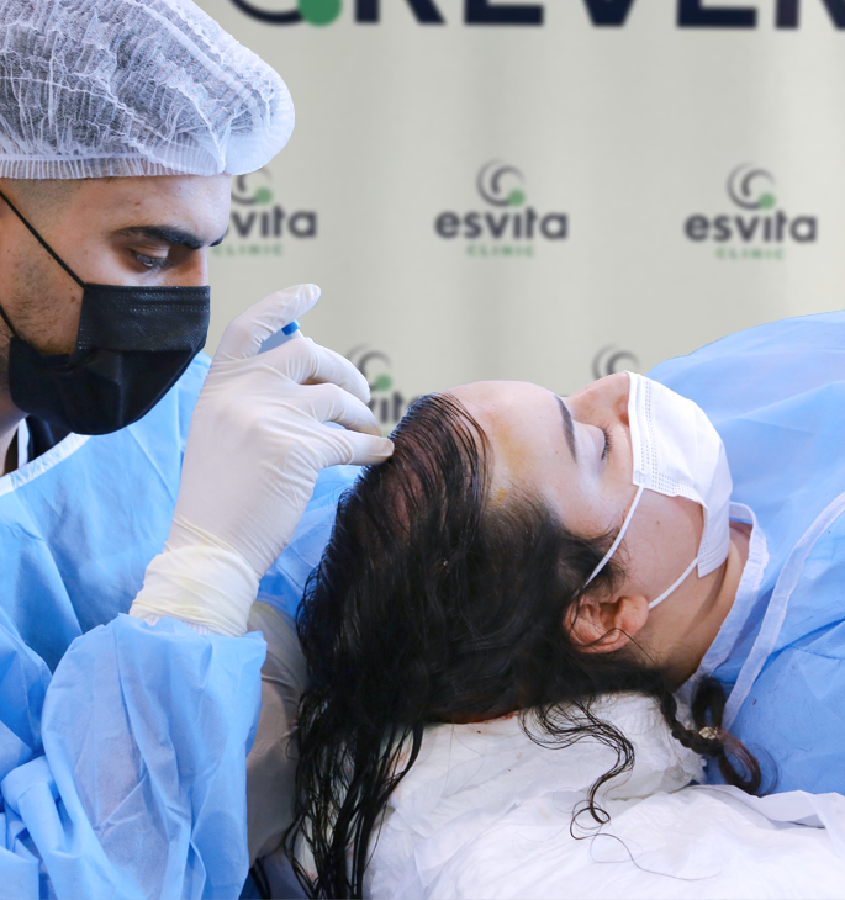 Female Hair Transplant