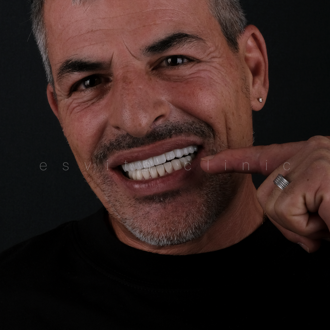 Зубной имплантат — до и после